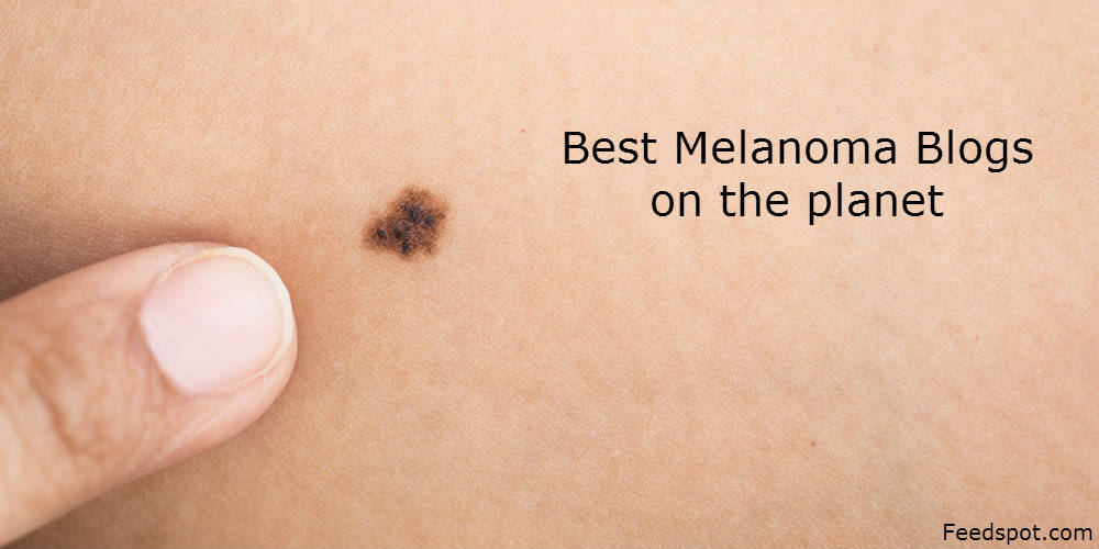 Top 70 Melanoma Blogs And Websites on the Web | Melanoma Blog